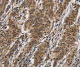 Anti-Human IL12RB2 Antibody - ABMIUM
