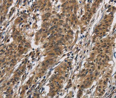 Anti-Human IL12RB2 Antibody