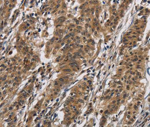 Anti-Human IL12RB2 Antibody