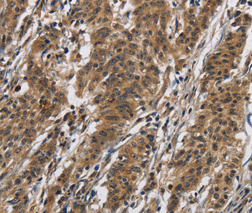Anti-Human IL12RB2 Antibody - ABMIUM