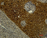 Immunohistochemistry of paraffin-embedded Human liver tissue using Transferrin Monoclonal Antibody at dilution of 1:50.