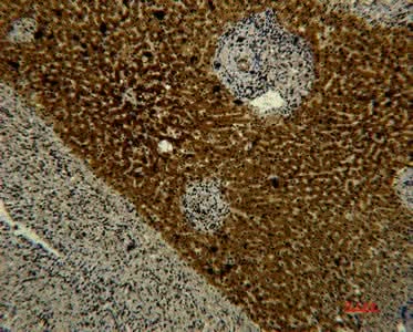 Immunohistochemistry of paraffin-embedded Human liver tissue using Transferrin Monoclonal Antibody at dilution of 1:50.