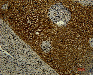 Immunohistochemistry of paraffin-embedded Human liver tissue using Transferrin Monoclonal Antibody at dilution of 1:50.