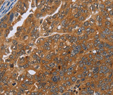 Anti-Human/Mouse ADAMTS15 Antibody - ABMIUM