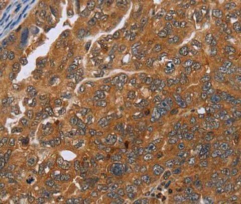 Anti-Human/Mouse ADAMTS15 Antibody