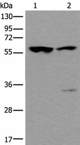 Western blot analysis of Mouse testis tissue and Human testis tissue lysates using TRIM27 Polyclonal Antibody at dilution of 1:400
