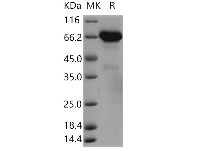 Recombinant Human ERP72/PDIA4 Protein (aa 1-641, His Tag) - ABMIUM