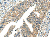 Anti-Human/Mouse AIFM2 Antibody - ABMIUM