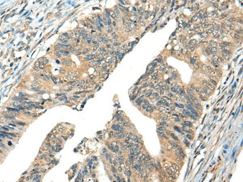 Anti-Human/Mouse AIFM2 Antibody - ABMIUM