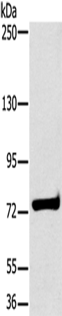 Anti-Human/Mouse/Rat HSD17B4 Antibody - ABMIUM