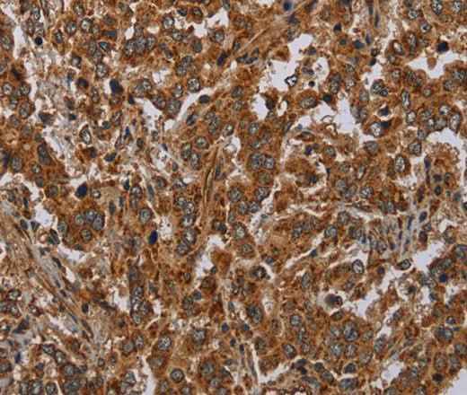 Anti-Human ATP2A1 Antibody