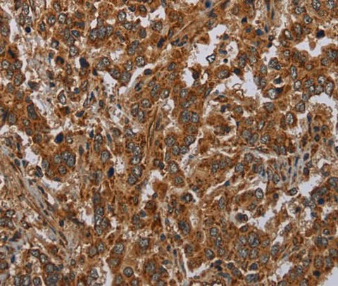Anti-Human ATP2A1 Antibody - ABMIUM