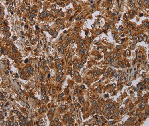 Anti-Human ATP2A1 Antibody - ABMIUM