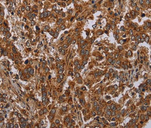 Anti-Human ATP2A1 Antibody - ABMIUM