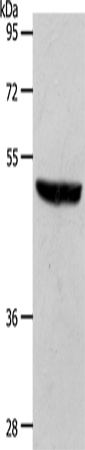Anti-Human/Mouse/Rat S1PR1 Antibody - ABMIUM