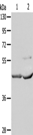 Anti-Human/Mouse/Rat NCEH1 Antibody - ABMIUM