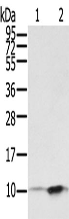 Anti-Human S100P Antibody - ABMIUM