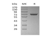 Recombinant Human GALNT7 Protein (His Tag) - ABMIUM