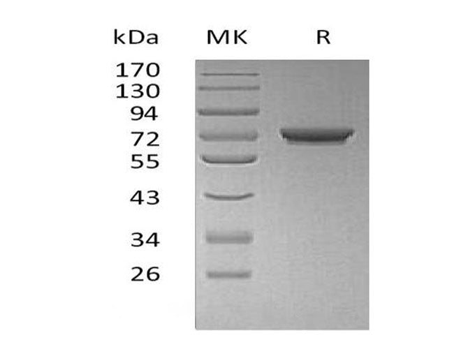 Recombinant Human GALNT7 Protein (His Tag) - ABMIUM