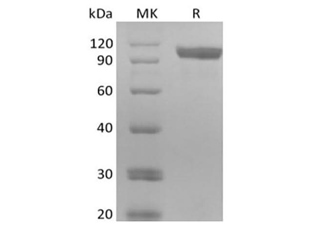 Recombinant Human Receptor Tyrosine-Protein Kinase ErbB-3/HER3 (C-6His-Avi) Biotinylated - ABMIUM