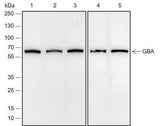 Anti-Human/Rat/Mouse GBA Antibody [A678]