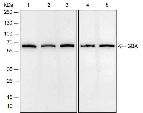 Anti-Human/Rat/Mouse GBA Antibody [A678] - ABMIUM