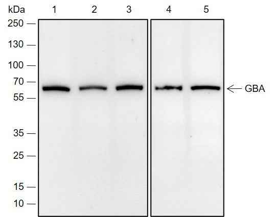 Anti-Human/Rat/Mouse GBA Antibody [A678]