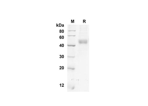 SDS-PAGE analysis of Mouse NRG-1 proteins, 2 μg/lane of Recombinant Mouse NRG-1 proteins was resolved with SDS-PAGE under reducing conditions, showing bands at 6.6 kDa.