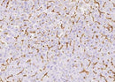 Anti-Human FCGR3B Antibody [A1052] - ABMIUM