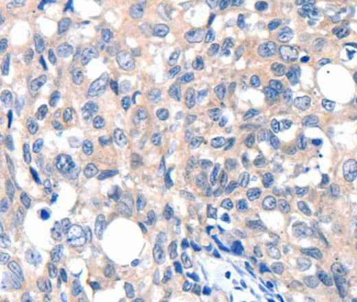 Anti-Human/Mouse/Rat GRIN2D Antibody
