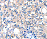 Anti-Human/Mouse/Rat GRIN2D Antibody - ABMIUM