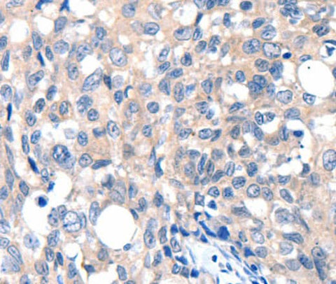 Anti-Human/Mouse/Rat GRIN2D Antibody - ABMIUM