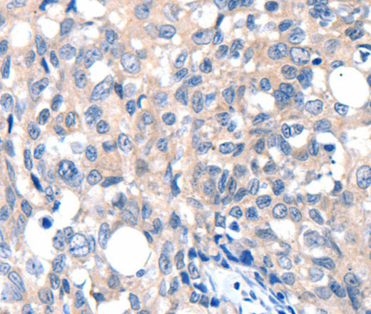 Anti-Human/Mouse/Rat GRIN2D Antibody - ABMIUM