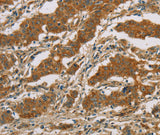Anti-Human CYP39A1 Antibody - ABMIUM