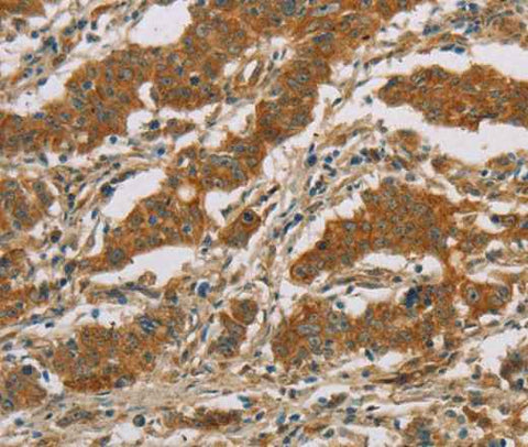 Anti-Human CYP39A1 Antibody
