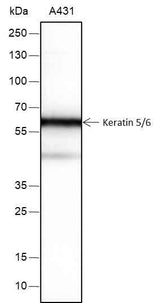 Anti-Human Keratin 5/6 Antibody [A280]
