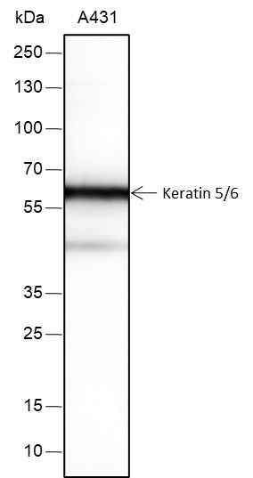 Anti-Human Keratin 5/6 Antibody [A280]
