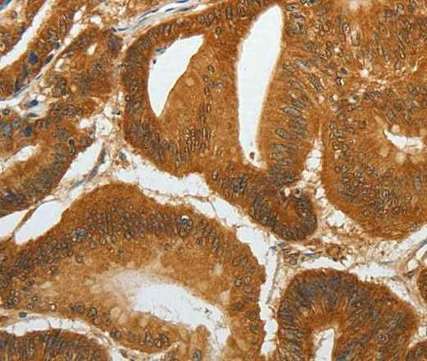 Anti-Human RETNLB Antibody