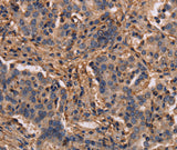 Anti-Human MAP1LC3C Antibody - ABMIUM