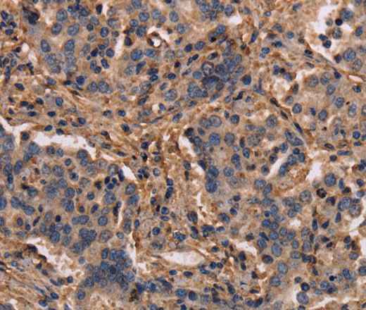 Anti-Human MAP1LC3C Antibody