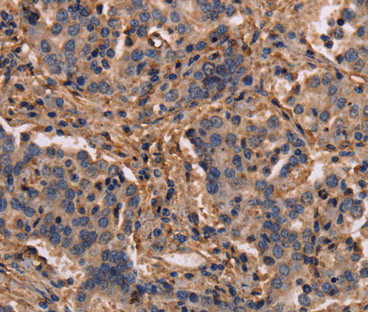 Anti-Human MAP1LC3C Antibody - ABMIUM