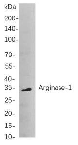 Anti-Human/Mouse/Rat Arginase-1 Antibody [B820]