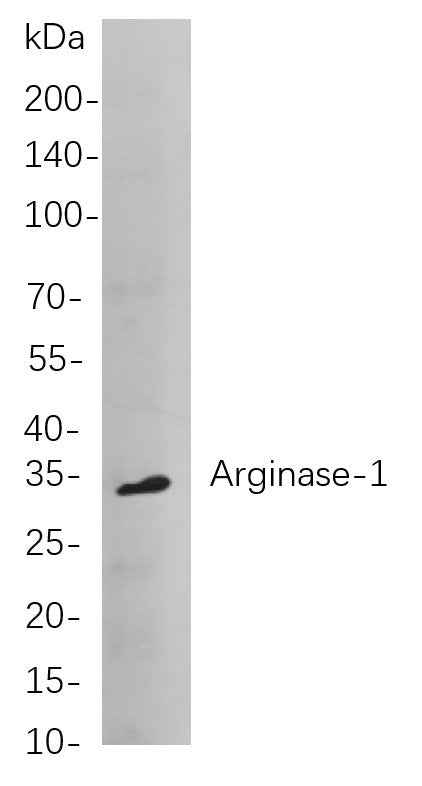 Anti-Human/Mouse/Rat Arginase-1 Antibody [B820] - ABMIUM