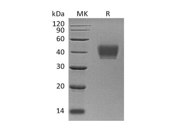 Recombinant Human KIR2DL3 Protein (His Tag) - ABMIUM