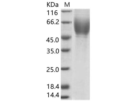 Recombinant HCV (serotype 1c,isolate HC-G9) E2 Protein (His Tag) - ABMIUM
