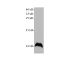 Anti-Human/Mouse/Rat S100A6 Antibody - ABMIUM
