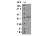 > 80 % as determined by reducing SDS-PAGE.