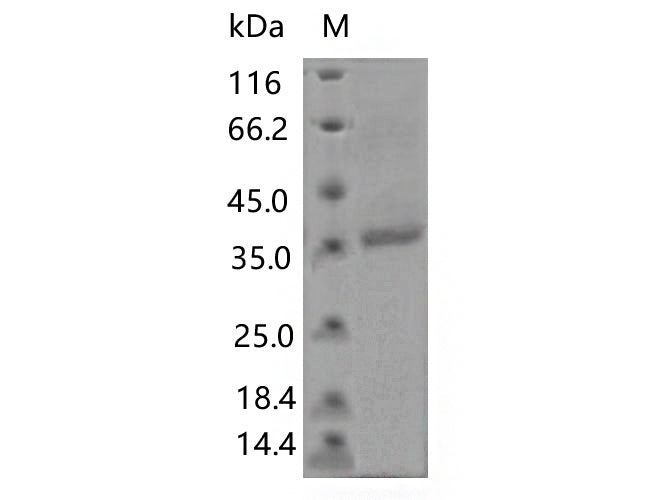 > 80 % as determined by reducing SDS-PAGE.