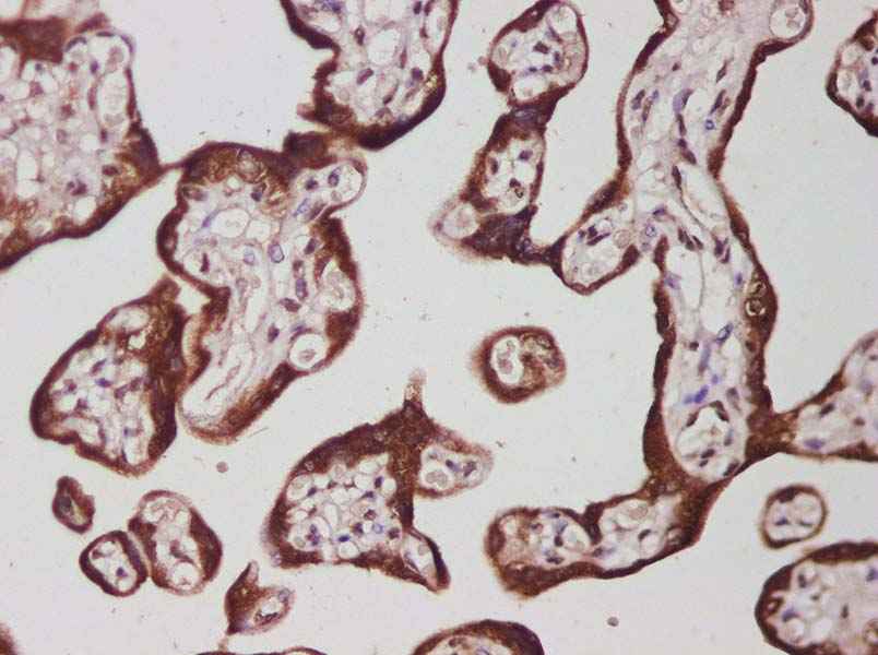Anti-Human IL-27B Antibody - ABMIUM