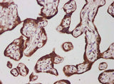 Anti-Human IL-27B Antibody - ABMIUM